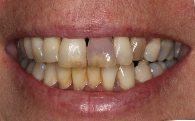 Florida Dental Implant & Aesthetic Center