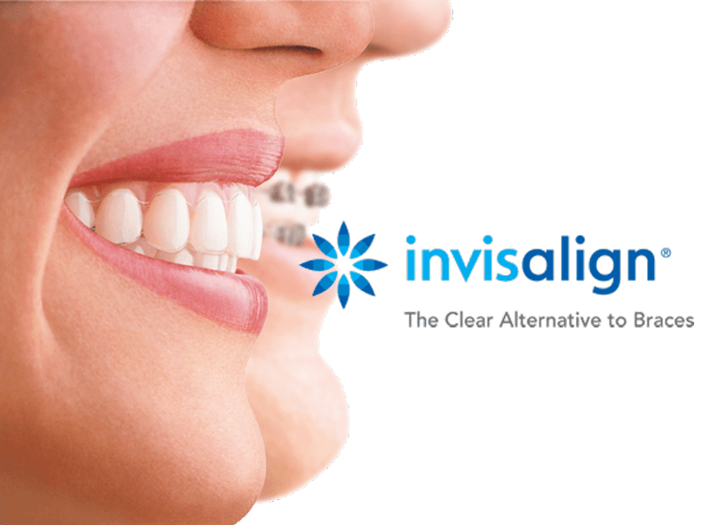 Grove Creek Dental