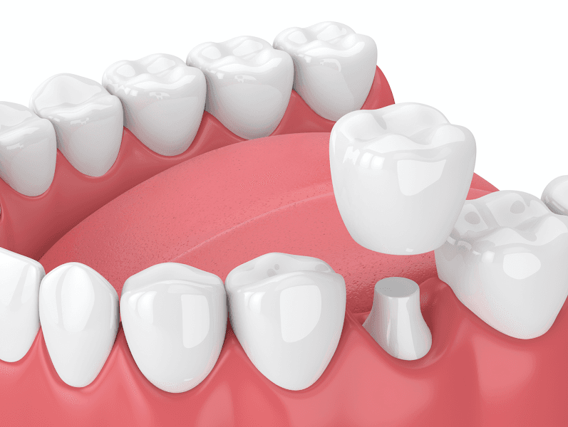 Mass Dental Associates