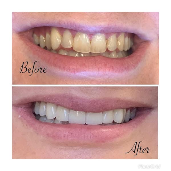 NorthStar Dental