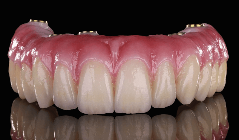 Northeast Lincoln Family Dentistry