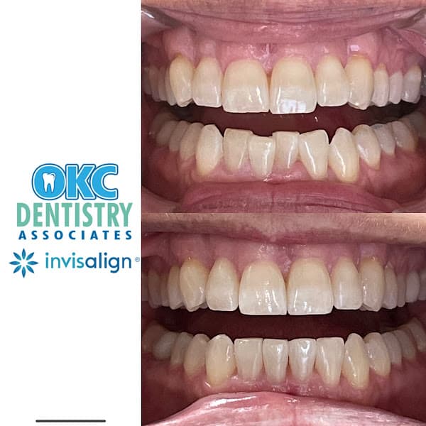 OKC Dentistry Associates