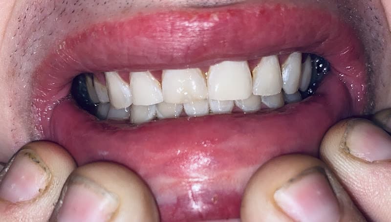 Open and Affordable Dental Cherry Creek