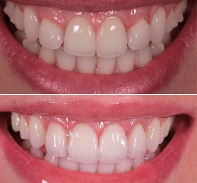Southpointe Family Dental