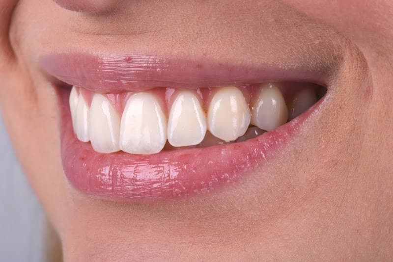 Texas Dental Solutions Dr. Mireya Imitola D.D.S & Dr. Bruce Barbash D.D.S. Dallas