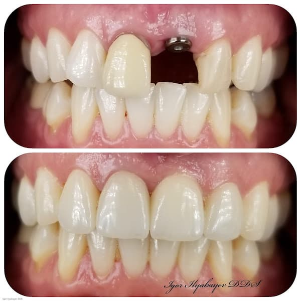Central Ave Dental — photo 3