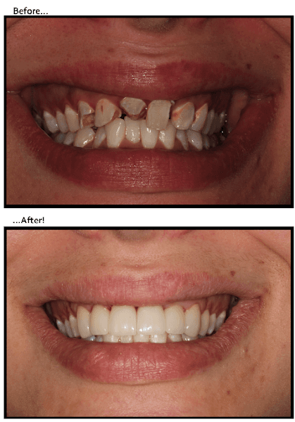 Tennessee Family Dental (Brentwood) — photo 3