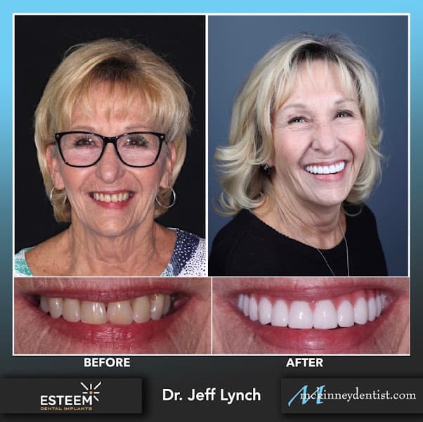 Esteem Dental — photo 2