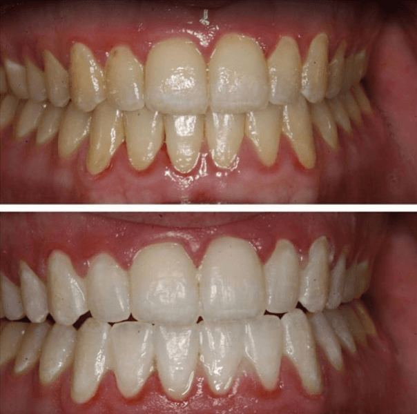 Charlotte Center for Cosmetic Dentistry — photo 2