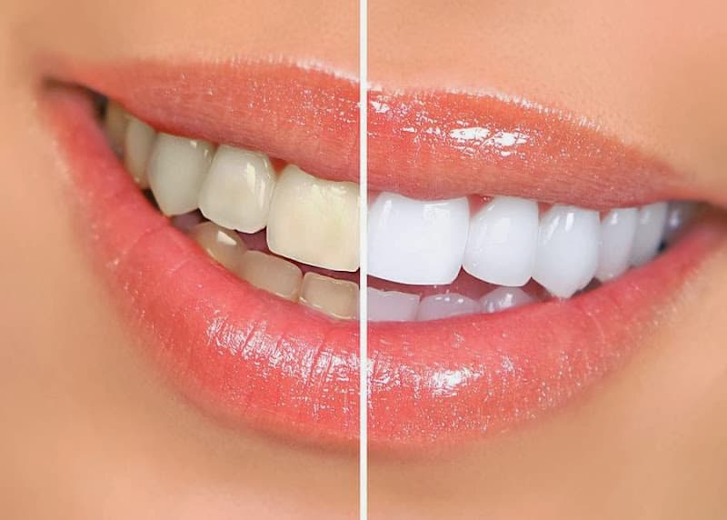 Dentist in Murray Utah Dr. Daniel W. Ormsby, DDS — photo 4