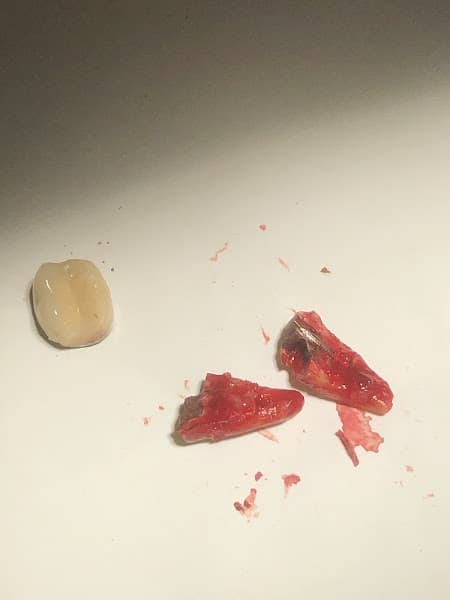 Burtonsville Dental Suite — photo 2