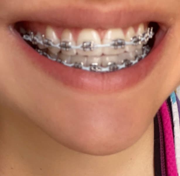 Comfort Dental Downtown Denver - Your Trusted Dentist in Denver — photo 3