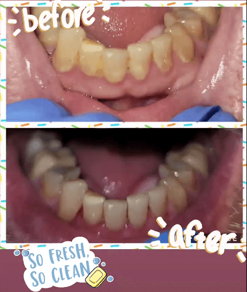 Tooth Fairy Mobile Dental Service — photo 3