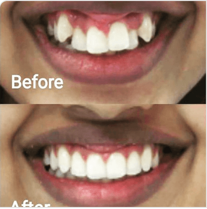 Virginia Center for Advanced Dentistry — photo 4