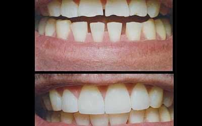 Forest View Dental — photo 3
