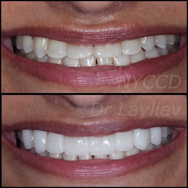 The New York Center for Cosmetic Dentistry - Dr. Emanuel Layliev — photo 3