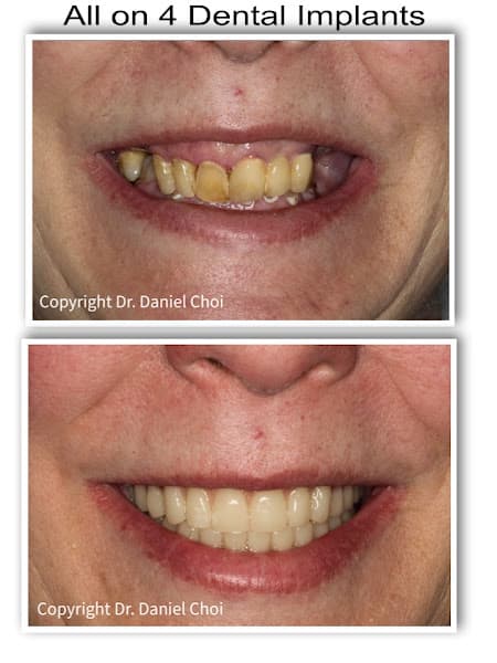 North Texas Dental Surgery Wisdom Teeth and Denture Implant Center — photo 3