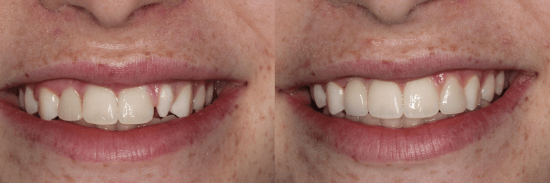 Cosmetic and Implant Dentistry of Connecticut — photo 4
