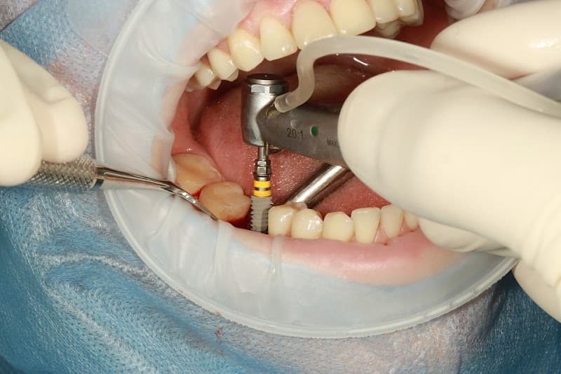 Chavez Family Dental — photo 4