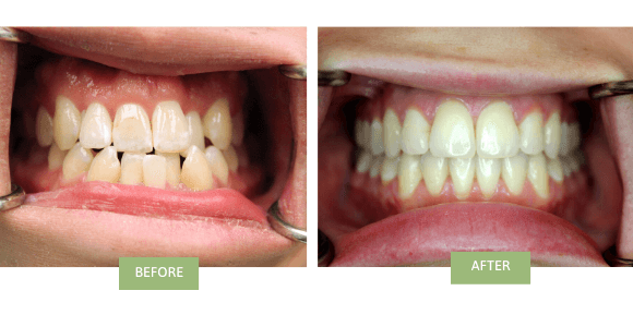 172 NYC Dental — photo 3