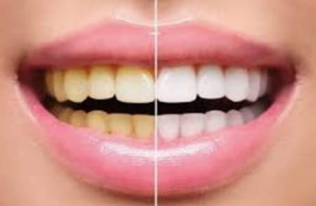 SK Dentistry, Dr. Scott Lee — photo 3