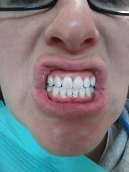Aspen Dental — photo 2