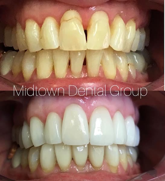 Midtown Dental Group Upper East Side — photo 4