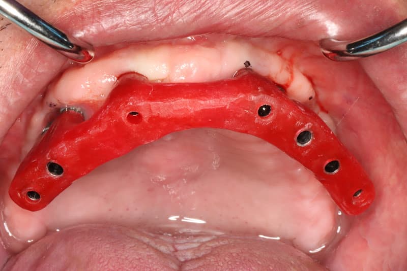 VA EPIC ( Virginia Esthetic Perio & Implant Center) — photo 4