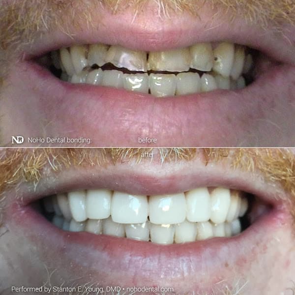 NoHo Dental - Dr. Stanton Young — photo 4