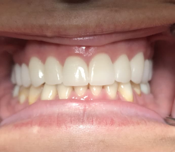 Precision Dental — photo 2