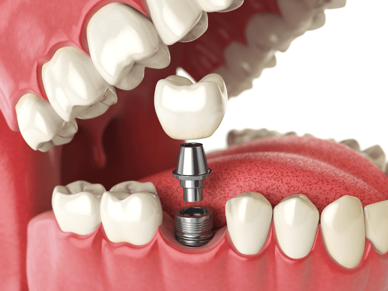 Mass Dental Associates — photo 2