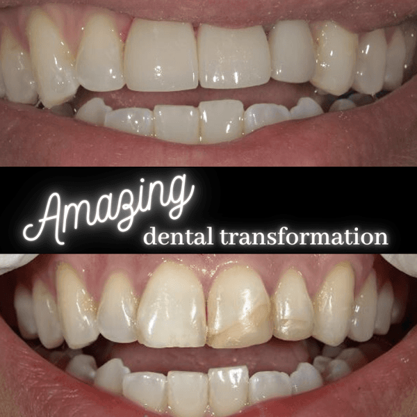 Coats Dental Group Family & Cosmetic Dentistry of Longmont — photo 4