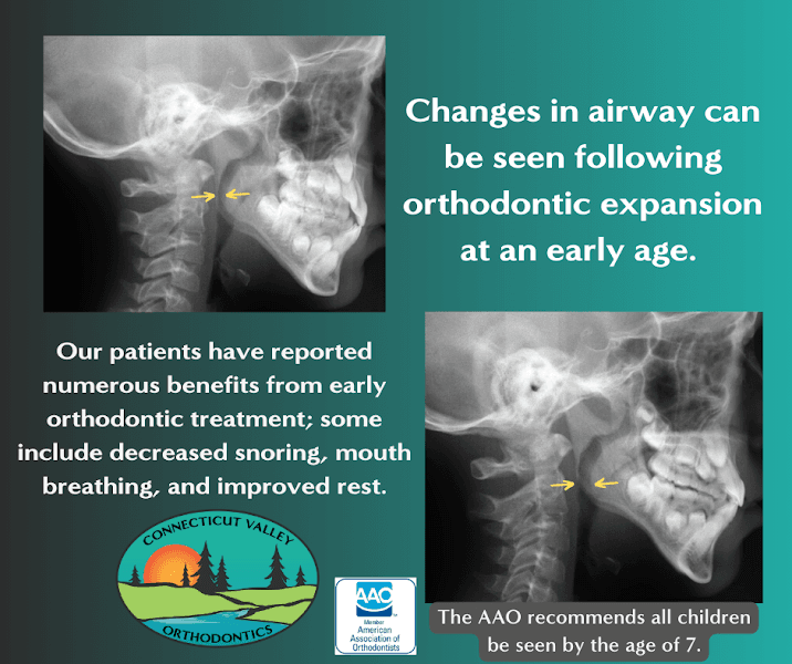 Connecticut Valley Orthodontics — photo 3