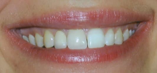 Dr. Alicia Ramos, DDS - Durham Dentist — photo 3
