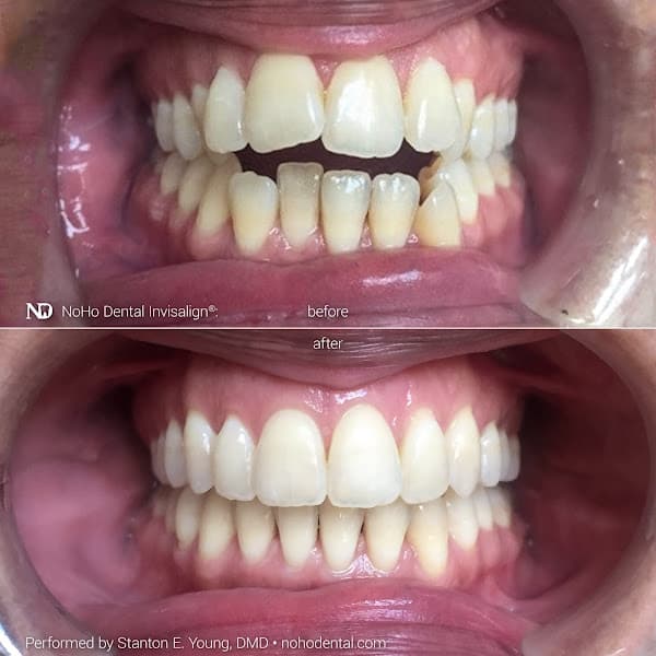NoHo Dental - Dr. Stanton Young — photo 3