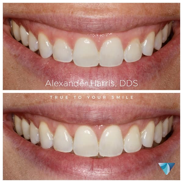 Vero Dental — photo 3