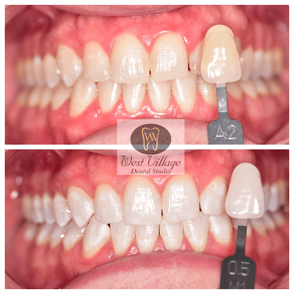 West Village Dental Studio — photo 3