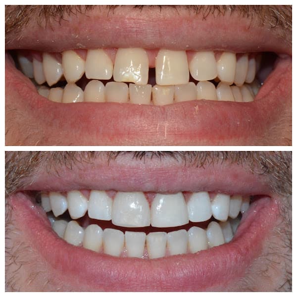 All Smiles Dentistry — photo 4