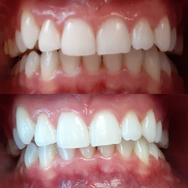 Nicholas Cosmetic Dental Center New York City — photo 2