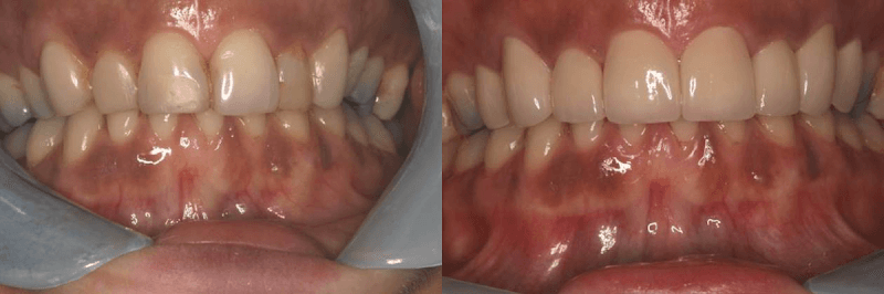 Advanced Dentistry of Connecticut — photo 4