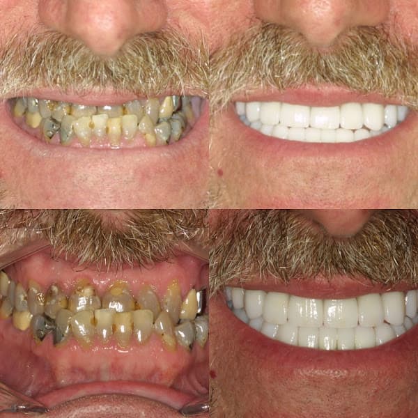 NJ Smile Center, Anthony Vocaturo, DDS, AAACD, FACE, FIADFE, FAGD — photo 2