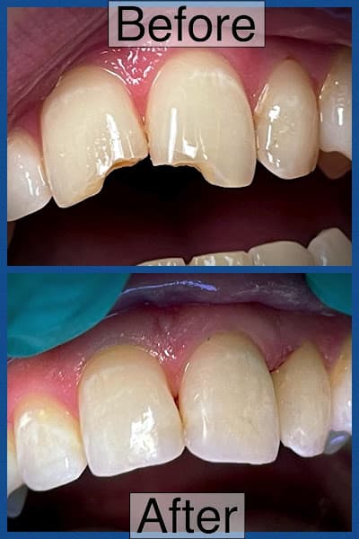 Mount Vernon Dental - Richard M. Sprang, DDS - Alexander J. Stoycheff, DDS — photo 2