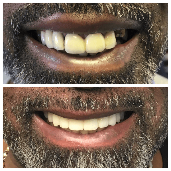 South Florida Dental Center of Coral Springs — photo 4
