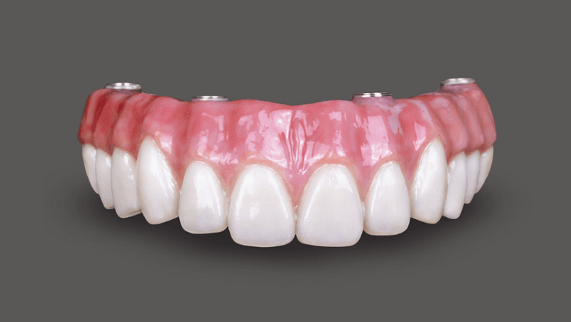 Periodontics and Dental Implants of North Carolina — photo 3