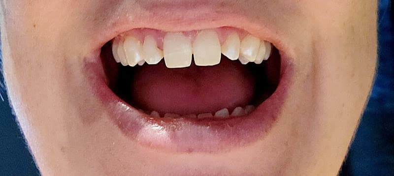 Wake Dental - Cary — photo 2