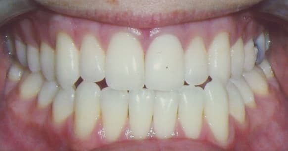 Dr. Alicia Ramos, DDS - Durham Dentist — photo 4