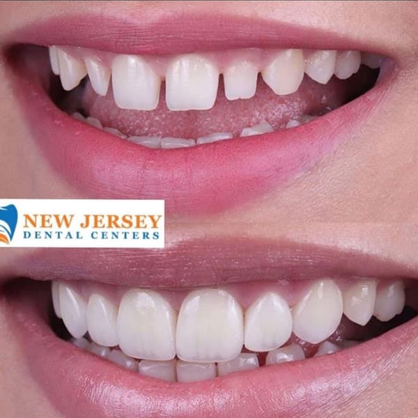 New Jersey Dental Centers — photo 3