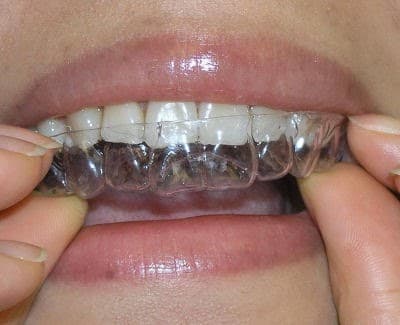 Forest View Dental — photo 2