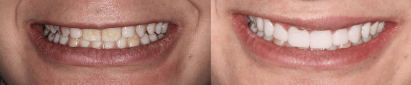 Cosmetic and Implant Dentistry of Connecticut — photo 3