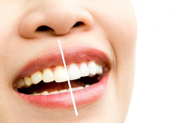 Island Dental - Dentist Gilbert, AZ — photo 2